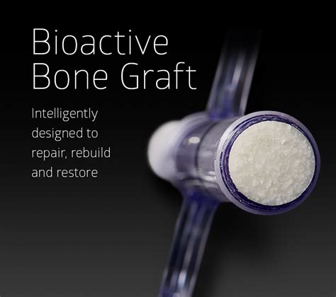 Bioactive Bone Graft - Unite Foot and Ankle | Development site