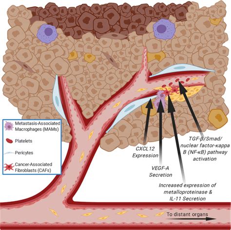 Rectal Cancer Vascular Invasion Metastasis Of Colorectal Cancer | The ...