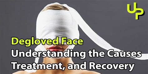 Degloved Face: Understanding the Causes and Treatment