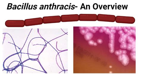 Bacillus anthracis- An Overview