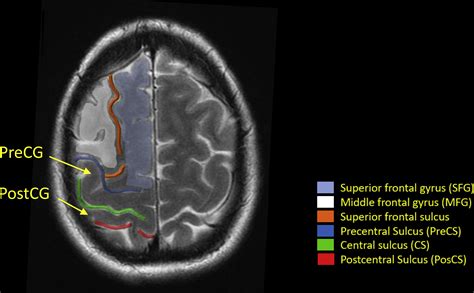 Functional Brain Anatomy | Radiology Key