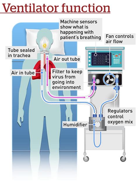 What is a ventilator and who gets one if COVID-19 turns catastrophic in ...