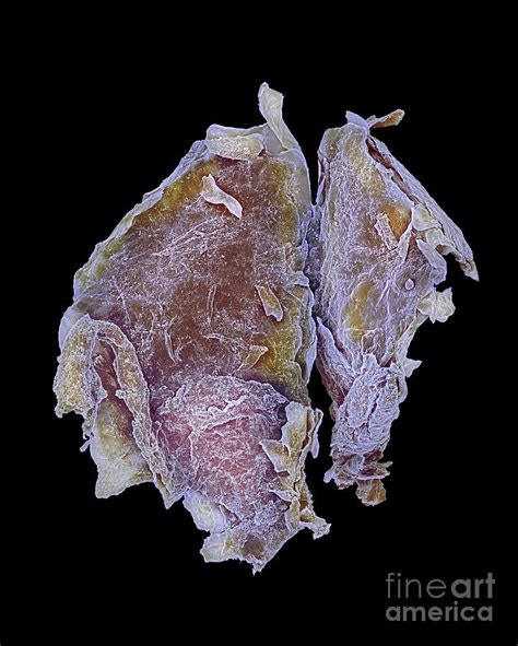 Dead Skin Photograph by Dennis Kunkel Microscopy/science Photo Library ...