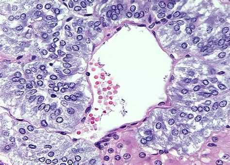 Histology of Adrenal Medulla