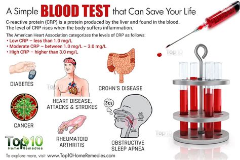 blood tests for infections - pictures, photos