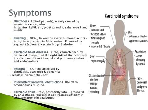 Apu domas & carcinoid syndrome