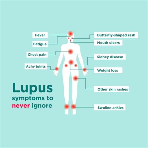 Learning About Lupus | Wellness Works NW