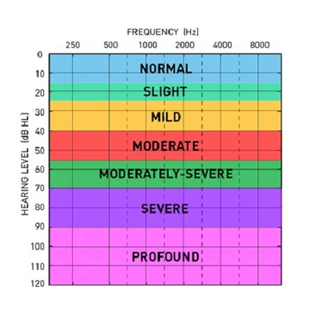 What Is An Audiogram? - My Baby's Hearing