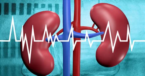 Renal Artery Stenosis Treatment | Renal Angiography