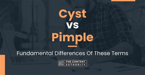 Cyst vs Pimple: Fundamental Differences Of These Terms