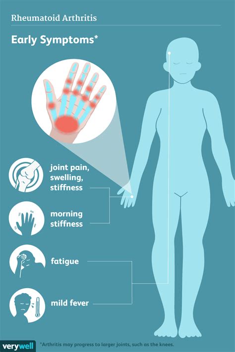 Rheumatoid Arthritis: Signs, Symptoms, and Complications