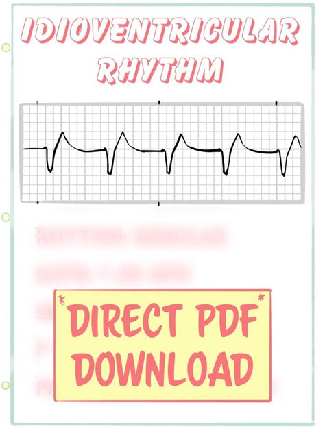 Idioventricular Rhythm ECG Guide: PDF Study Guide - Etsy