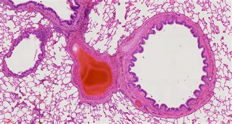 Human lung section histology slides, 7 µm sec., H&E Stain, human ...