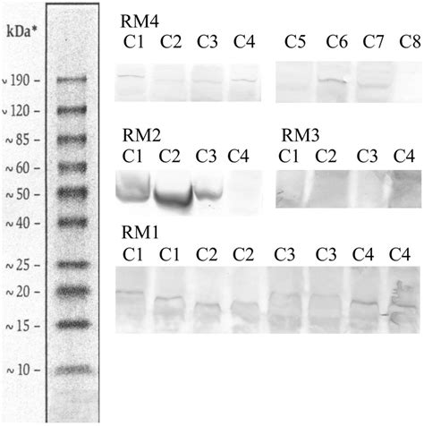 Detection of antibody binding to tumor cell lysates by Western ...