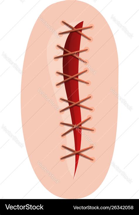 Wound suture icon cartoon style Royalty Free Vector Image