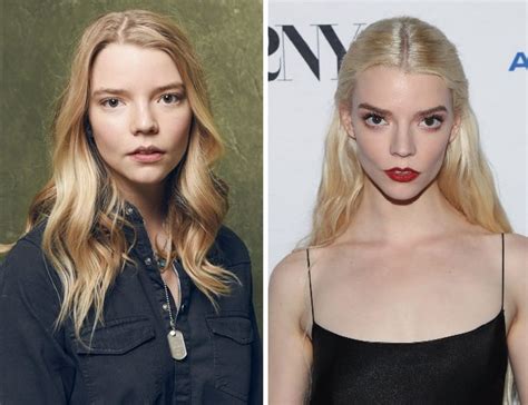 Anya Taylor-Joy Before and After Plastic Surgery