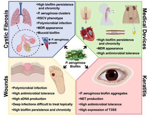 Pseudomonas aeruginosa biofilms and their partners in crime - Institute ...