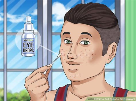 How to Get Rid of a Zit Overnight (with Pictures) - wikiHow