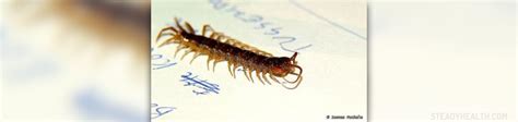 Centipede bite treatment | Allergies articles | Body & Health ...