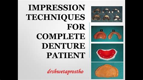 IMPRESSION TECHNIQUES FOR COMPLETE DENTURE PATIENT - YouTube