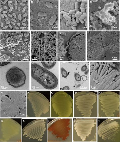 Scanning and transmission electron micrographic images showing ...