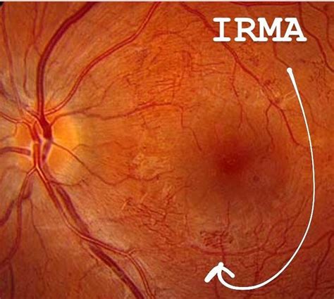 Ophthalmology-Notes And Synopses