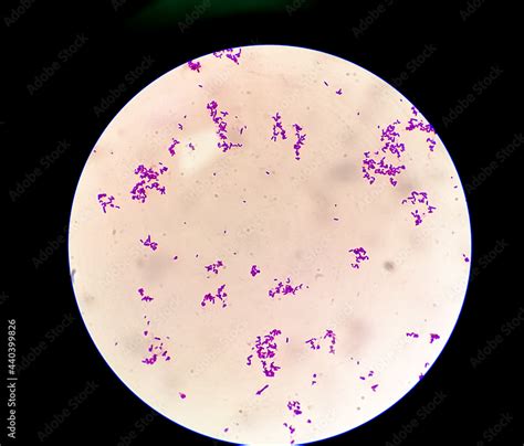 Streptococcus Gram Stain