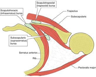 Scapulothoracic and Subscapular Bursae | Musculoskeletal Key