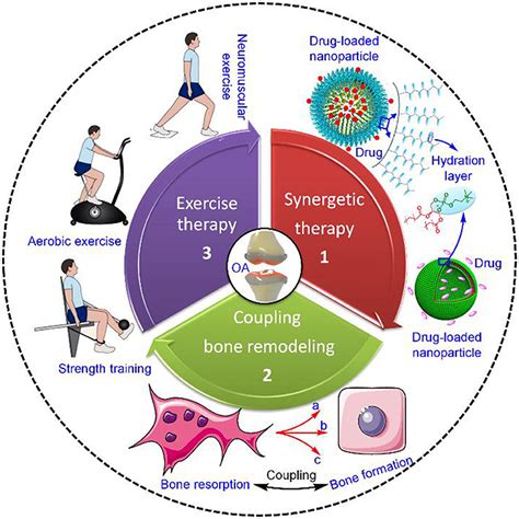 Understanding Osteoarthritis: Causes, Symptoms, and Treatment Options