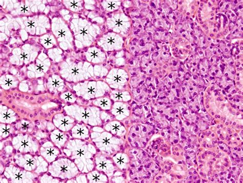 Sublingual Salivary Gland Histology Labeled