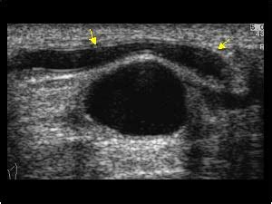 Musculoskeletal Joints and Tendons | 6.7 Ankle : Case 6.7.8 Medial ...