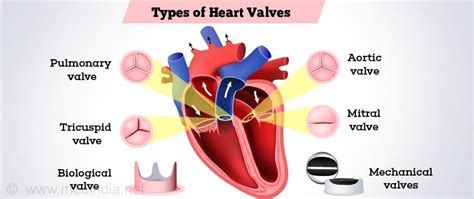 Prosthetic Heart Valves - Symptoms, Types, Advantanges, Disadvantages ...