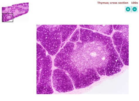 thymus histology Diagram | Quizlet