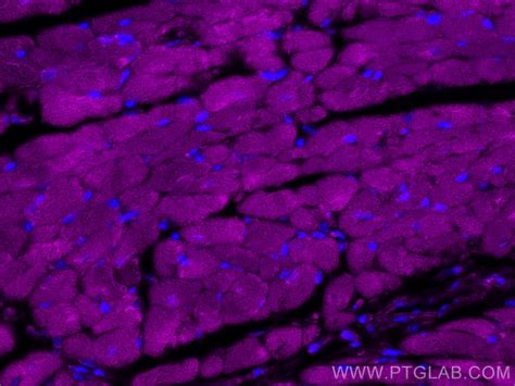 RYR2 antibody (CL647-27587) | Proteintech