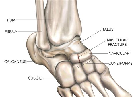 Talus Bone Chip Recovery at Ronald Martin blog