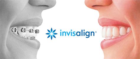 Invisalign Clear Braces Toronto | Teeth Straightening | Family Tree ...