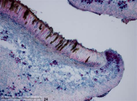 Cross section through a lichen ascocarp (fruiting body). The hymenium ...