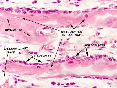 ossification of spongy bone histology - Google Search | Histologia