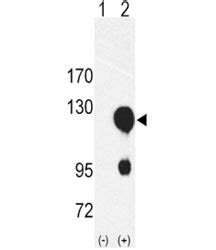 ROR2 Antibody | F50668 NSJ Bioreagents