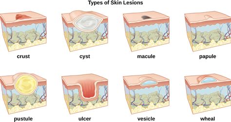 21.1: Anatomy and Normal Microbiota of the Skin and Eyes - Biology ...