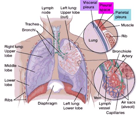 Pleurisy - Causes, Symptoms, Pain, Diagnosis & Treatment