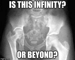 Funny xray Memes | Radiology humor, Chiropractic humor, Xray humor