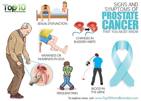 prostate-cancer-symptomsjpg - Medcare SpainMedcare Spain