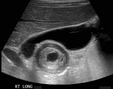 Congenital and Neonatal Abnormalities | Radiology Key