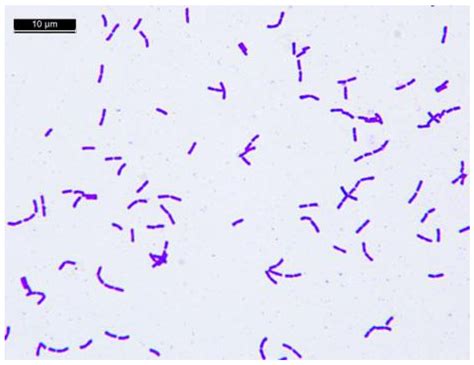 Lactobacillus Casei Gram Stain