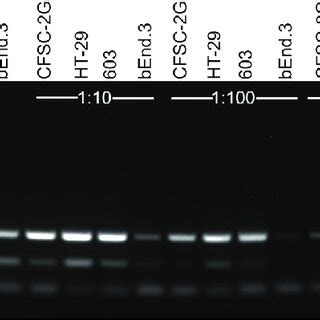 Level of mycoplasma contamination of four infected cell lines by PCR ...