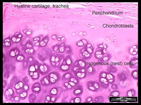 Hyaline cartilage, Cartilage, Human tissue