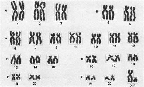 Human karyotypes