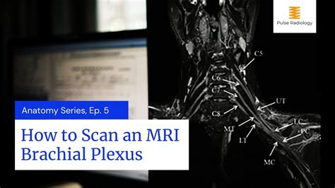 Brachial Plexus Mri