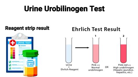 Ehrlich's Test Urobilinogen Detection In Urine, 42% OFF